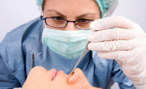 septorhinoplastie à Lyon