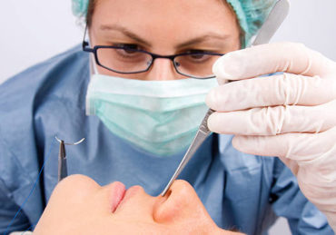 septorhinoplastie à Lyon