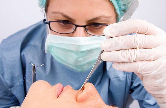 septorhinoplastie à Lyon